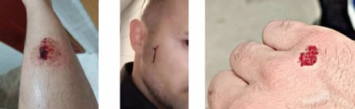 Un hombre agrede a varios policías al fallarles la táser por un problema electrónico